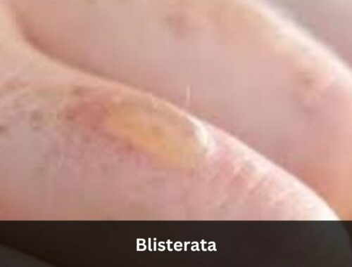 Blisterata