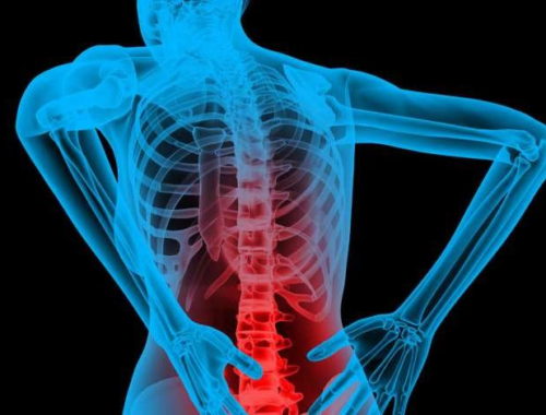 Common Causes of Back Pain and How to Prevent Them