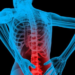 Common Causes of Back Pain and How to Prevent Them