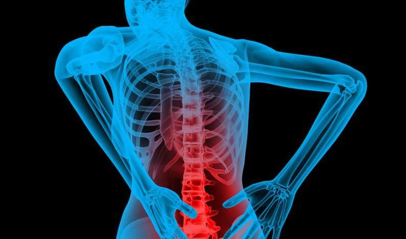 Common Causes of Back Pain and How to Prevent Them